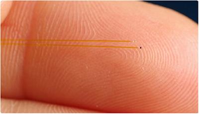 Intraluminal Monitoring of Micro Vessels. A Surgical Feasibility Study